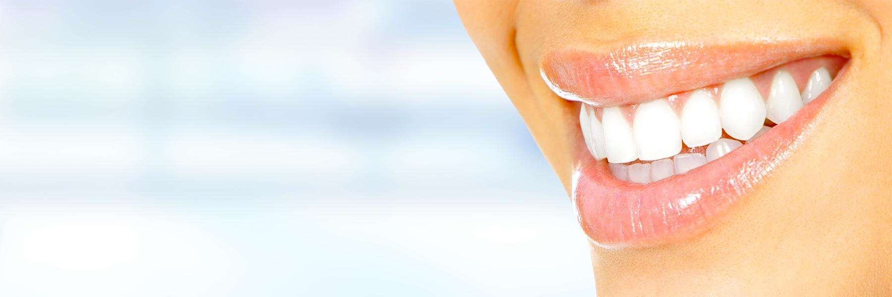 Dental Veneers | Dentist